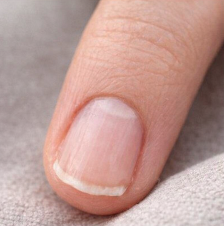 Înainte de tratament